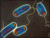 legionel·losi legionelosi legionel·la legionela bacteris virus