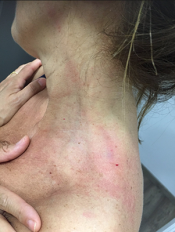 Les marques de l'agressió a Teresa Artigas