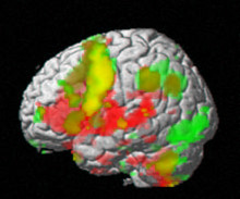 cervell humà