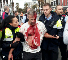 Els Mossos d'Esquadra ajuden un votant agredit per la policia espanyola