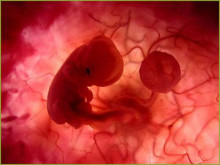 avortament fetus 