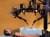 intervencions robòtiques cirurgia