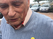 Un home de 82 anys ferit pels unionistes